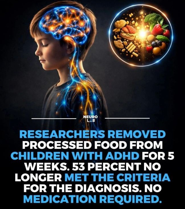 Researchers removed processed foods from children with ADHD diet with a majority no longer meeting ADHD diagnosis criteria diagram